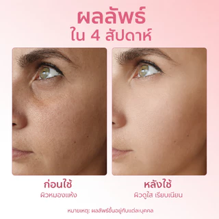 PAZIUM เซรั่ม เซรั่มไนอาซินามายด์ Whitening Essence กระจ่างใส ลดรอยด่าง รอยสิว ฝ้า กระ 20ML
