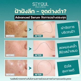 Advanced Youth Activating Serum Seyoul เอสเซ้นส์บำรุงผิว กระ จุดด่างดำ เติมความชุ่มชื้น ฟื้นฟูผิว 50ml