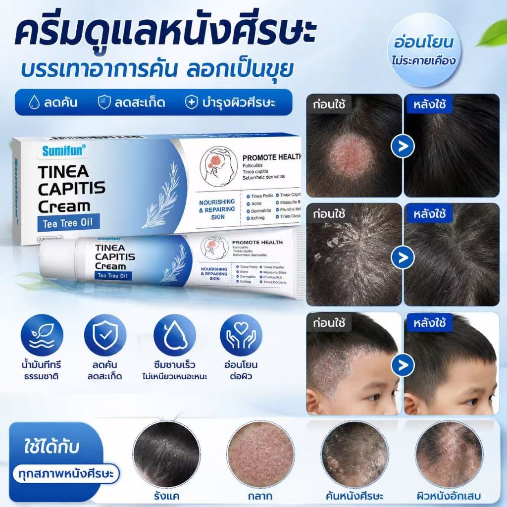 ครีมดูแลหนังศีรษะ Sumifun Tea Tree Oil 20g ครีมบำรุงหนังศีรษะ ดูแลอาการคัน รังแค สะเก็ดผิว ลดความระคายเคือง สูตรทีทรีออย