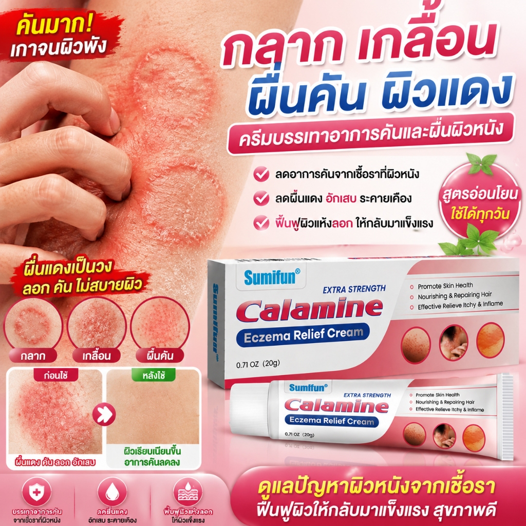 ครีมลดอาการคัน รักษาได้ผลดี สะเก็ดเงินครีม โรคผิวหนัง เกลื้อน กลาก อาการคันผิวหนัง ผิวหนังอักเสบ ผื่นแพ้ ผดร้อน และลมพิษ
