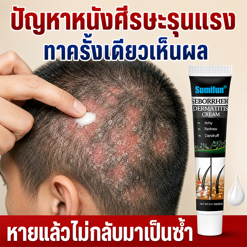 ครีมลดอาการคัน สูตรคุมมัน ลดคัน ดูแลหนังศีรษะ เหมาะสำหรับผิวที่มีปัญหา กลาก สิว และเชื้อรา ครีมแก้คัน สะเก็ดเงินครีม