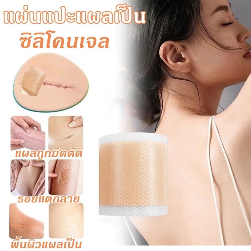 แผ่นซิลิโคนแผ่นแปะ กันน้ำและสามารถตัดให้ได้ขนาดตามต้องการ  ปกปิดรอยแผลเป็น ใช้ซ้ำได้ 4x150 ซม