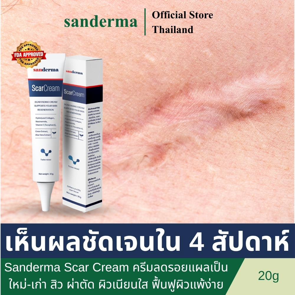 Sanderma Scar Cream ครีมลดรอยแผลเป็นใหม่-เก่า สิว ผ่าตัด ผิวเนียนใส ฟื้นฟูผิวแพ้ง่าย