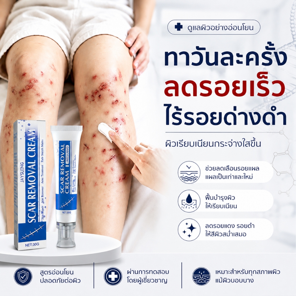 บอกลารอยแผลเป็น เจลซ่อมแซมรอยแผลเป็น เจลรอยแผลเป็น ครีมทาแผลเป็น ครีม สําหรับรอย ผ่าตัด น้ําร้อนลวก
