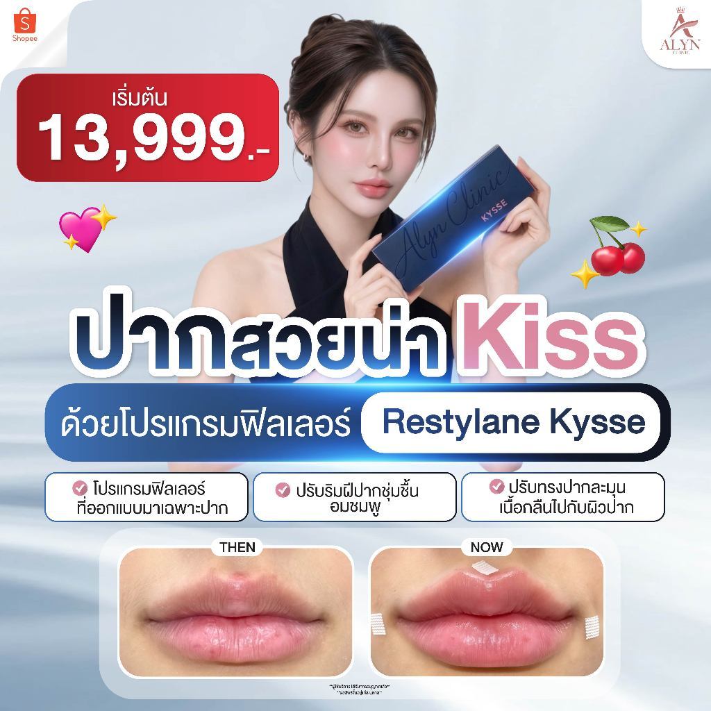 โปรแกรมฉีดฟิลเลอร์ปาก Restylane Kysse แท้ 100% ปากอวบอิ่ม อมชมพู ละมุน - ALYN Clinic