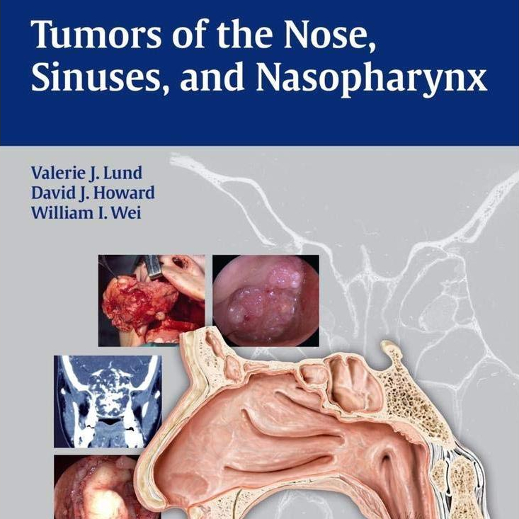 หนังสือ Tumors of the Nose, Sinuses and Nasopharynx ed 1/2014