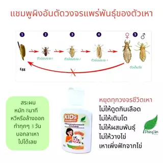 แชมพูสมุนไพร กำจัดเหา และ ไข่เหา หยุดคันใน5-10นาทีสบายหัวเด็กๆชอบ ผิงอันเฮอแบ็ล ของแท้