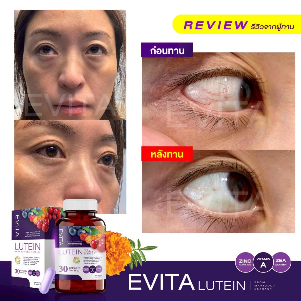 EVITA LUTEIN เอวิต้าลูทีน วิตามิน บำรุงดวงตา บำรุงสายตา ลูทีน thumbnail 5