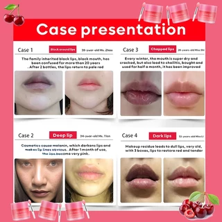 ลดริมฝีปากคล้ำ แก้ดำโดยไม่เด้ง ครีมทาปากชมพู นำเข้าเดิม Lip Sleeping Mask Berry Lip Treatment 20g ลิปมาส์ก ลิปบาล์ม คงคว