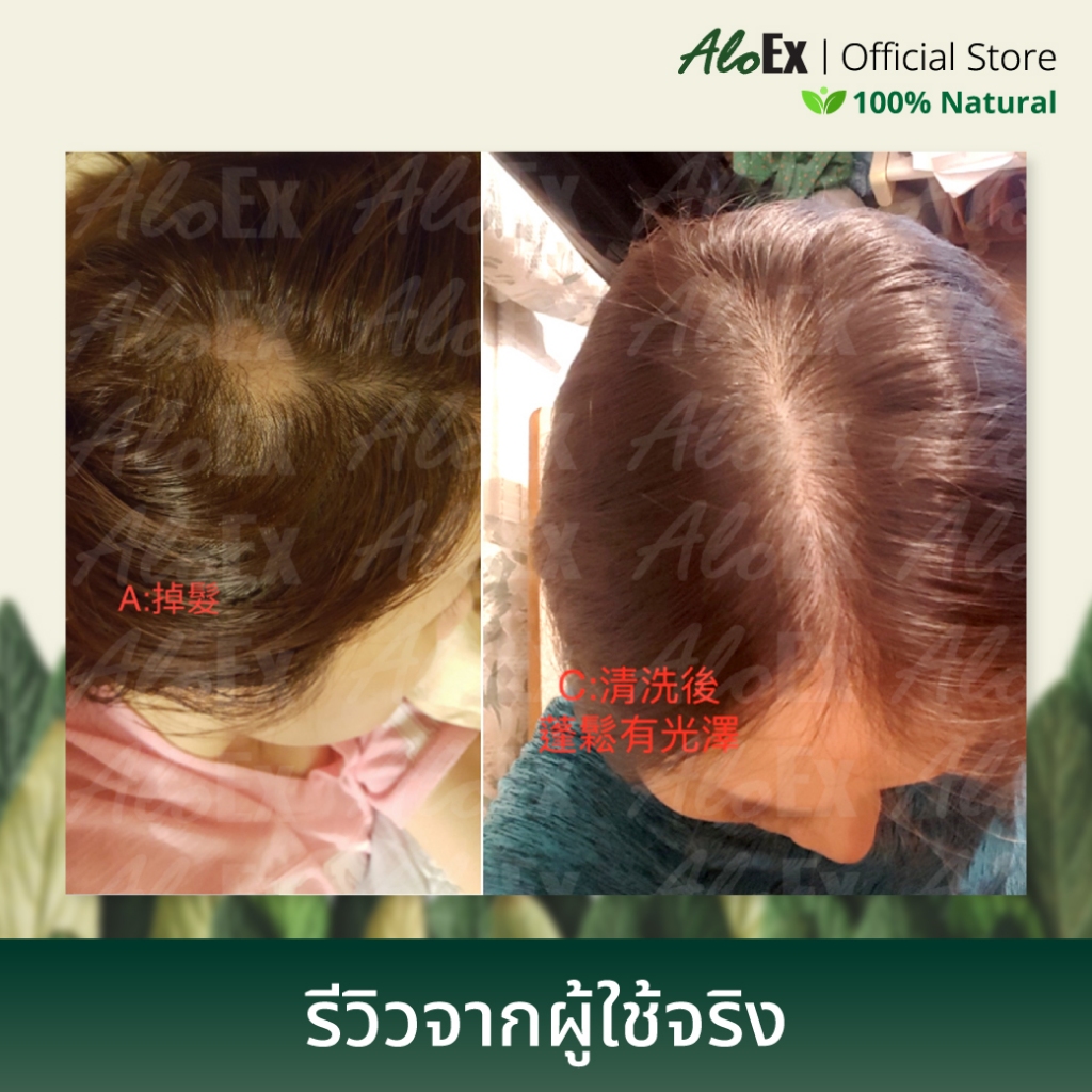 [เซตสุดคุ้ม] AloEx Extra Mild Shampoo, AloEx Hair Mask, AloEx Hair Serum 120 ml. เซตลดผมร่วง บำรุงผมหนา สำหรับผิวแพ้ง่าย - รูปที่ 5