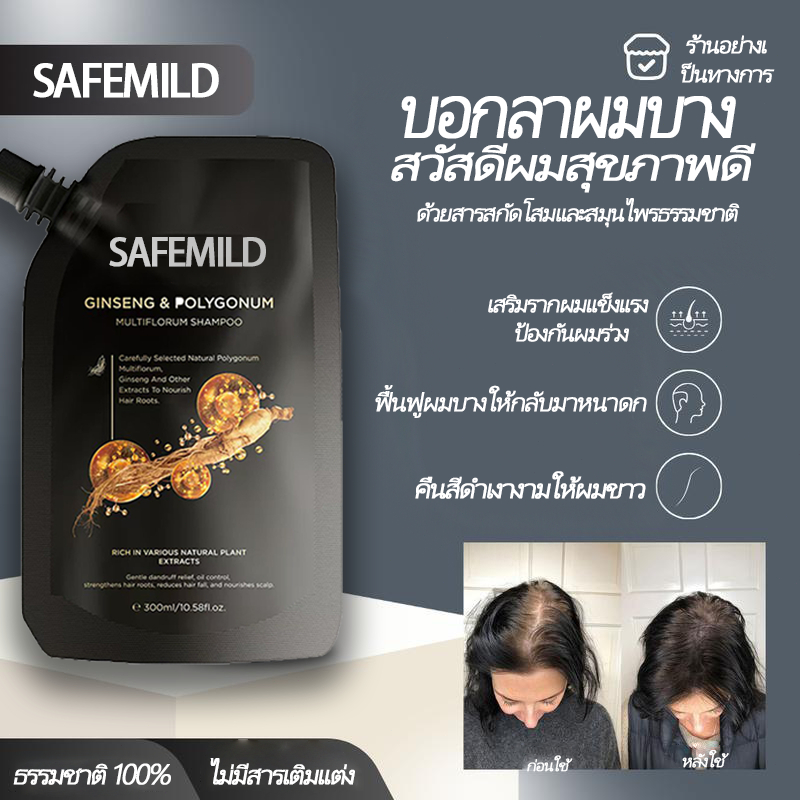 [Double Effect]แชมพูโสม SAFEMILD 300ml แชมพูป้องกันผมร่วง ปิดผมขาว ลดอาการผมร่วง ผมบาง แก้ปัญหารังแค