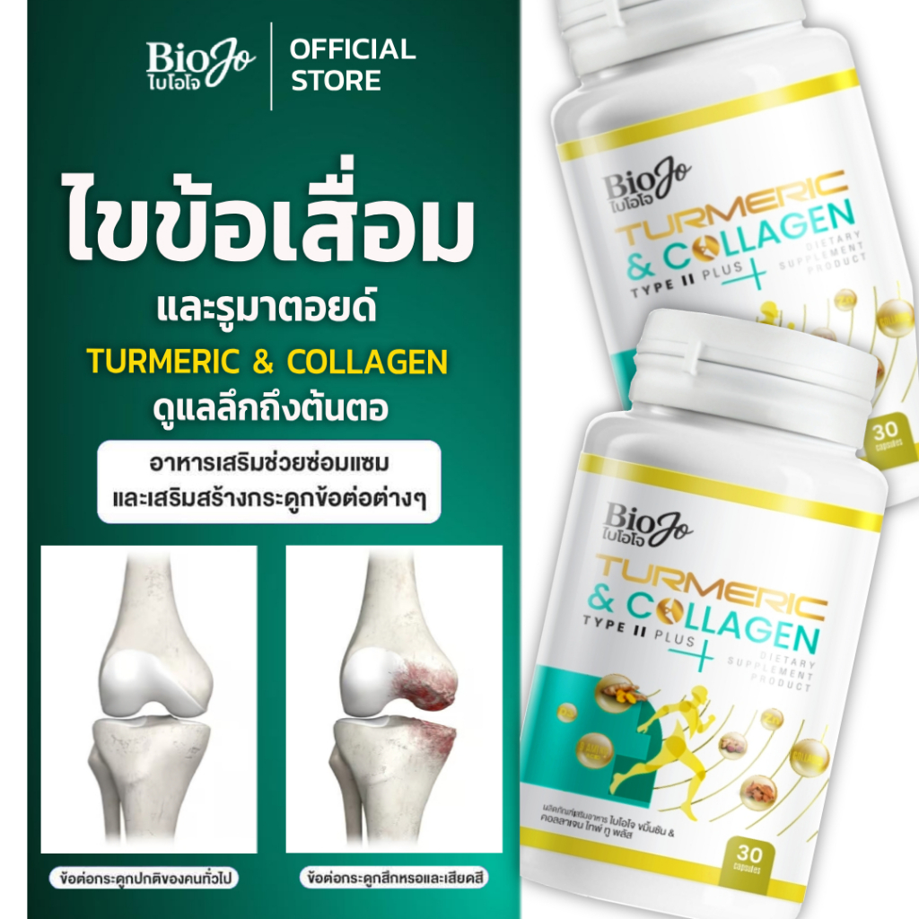 BIOJO နနွင်း & Collagen Type II Plus [1 ထပ်1] အဆစ်/အရိုးဘำလုံး (အဖျားရောင်မှု လျော့) (30 ဆေးတောင့်/ဘူး)