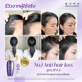 [Complete Set] DAENG GI MEO RI แชมพูลดผมร่วง JINGI Anti-Hair Loss Shampoo+Treatment+ScalpTonic