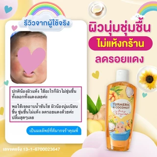 เจลอาบน้ำเด็กซันโช ลดอาการคัน ผดผื่น บำรุงผิวเนียนนุ่ม ขจัดแบคทีเรีย กลิ่นหอม ปลอดภัยกับลูกน้อย