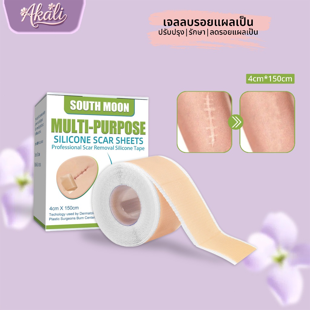 South Moon รักษารอยแผลเป็น แผ่นแปะแผลเป็น กําจัดรอยแผลเป็นจากแผลเป็น เผยผิวเนียนสวย