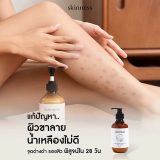 [พร้อมส่งทุกวัน] skinness brightening dark spot body lotion | ครีมลดรอยผิวกายฝาดำ