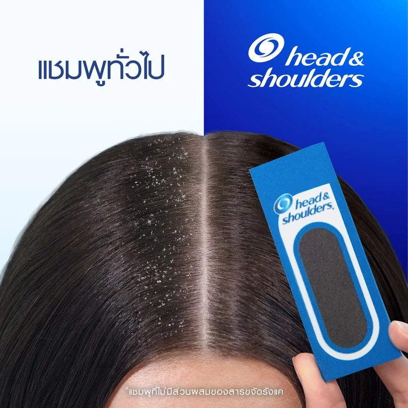 [แพคคู่] Head and Shoulders แชมพูขจัดรังแค สูตร แอปเปิ้ลเฟรช 370 มล x2|Anti Dandruff Shampoo Apple Fresh ผลิตภัณฑ์ดูแลผม thumbnail 5