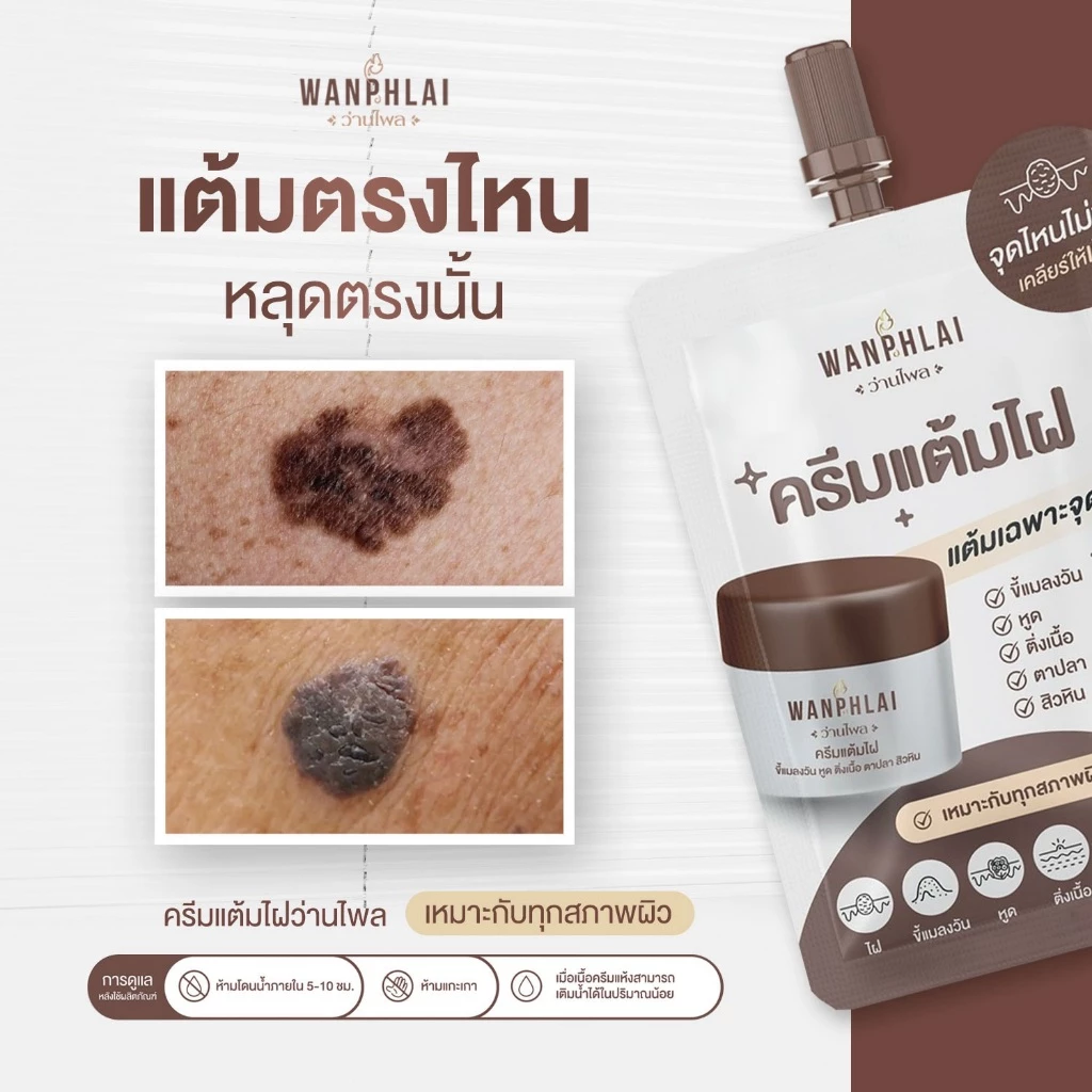 ครีมแต้มไฝ ว่านไพล ขี้แมลงวัน ติ่งเนื้อ หูด ตาปลา แก้ปัญหา สิวหิน ครีมกำจัดไฝว่านไพล ไฝ หูด จี้ไฝ แต้มไฝ ขนาด 1.2 กรัม thumbnail 8