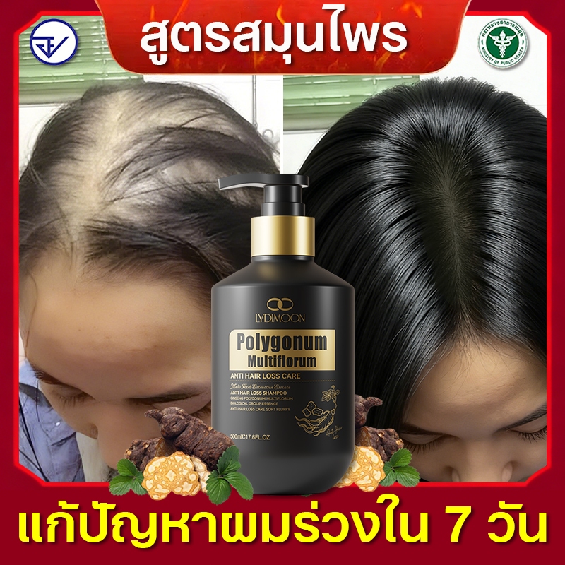 แชมพูลดผมร่วงหนัก แชมพูปลูกผม แชมพูโสมเหอโช่วอู 500ml สาระสำคัญของสมุนไพร บำรุงรากผม ป้องกันหัวล้าน เร่งผมยาว