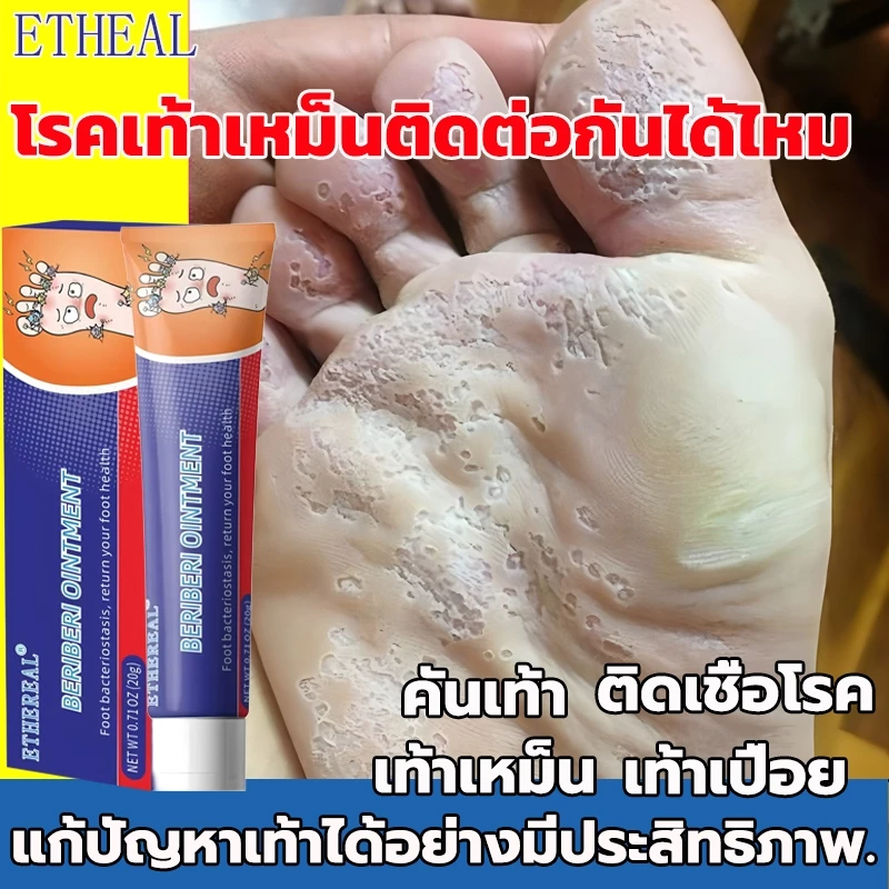 ครีมลดกลิ่นเท้า (ประสิทธิภาพดี เห็นผลเร็ว)แก้ไขปัญหาเท้า ระงับกลิ่นเท้า