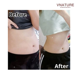 Artiscent วิตามินดูแลรูปร่าง L-Carnitine V-Nice 30 แคปซูล มีสารสกัดธรรมชาติจากพืช 10 ชนิด
