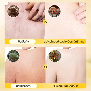เจลอาบน้ำป้องกันไรฝุ่นกำมะถัน ครีมอาบน้ําลดสิว 500ml กำจัดไรลดสิว แก้คัน ลดการสะสมของแบคทีเรีย 99.8% ลดสิวที่หลัง