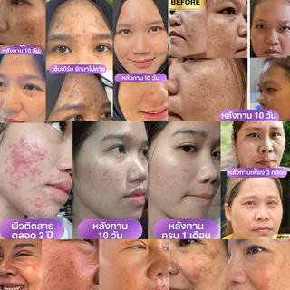 NUTRIC C เซ็ต 3 กล่อง | คอลลาเจนเกรดพรีเมี่ยม ผิวใสเด้งไว | เติม-กระตุ้น-ปกป้องครบจบใน1ซอง |
