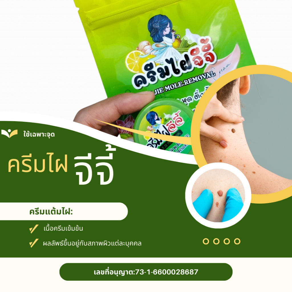 ครีมไฝ จีจี้ แต้มไฝ ขี้แมลงวัน หูด ตาปลา ติ่งเนื้อ แต้มไฝ แต้มขี้แมลงวัน กระเนื้อ สิวหิน แต้มตาปลา ทาไฝ จี้ไฝ แต้มหูด 21