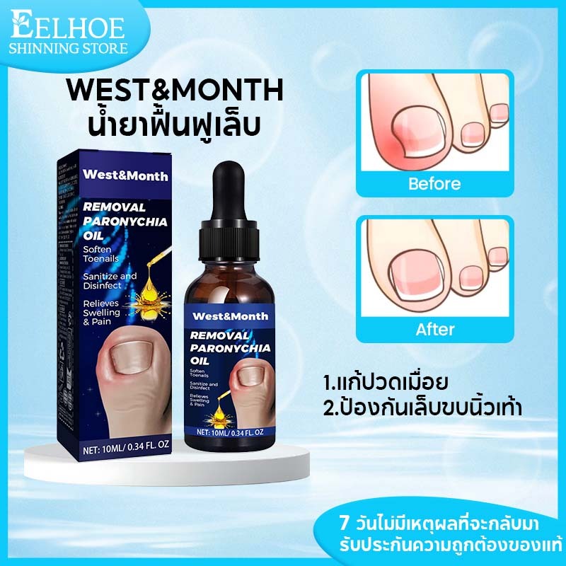 West&Month น้ำยาฟื้นฟูเล็บ ฆ่าเชื้อรา บำรุงเล็บ ป้องกันเล็บขบนิ้วเท้า ทําความสะอาดและปกป้องเล็บ 10ml