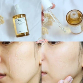 [ Set คู่ ]SKIN1004 Madagascar Centella Tea-Trica Relief Ampoule 100 ml + Madagascar Centella Ampoule 100 ml