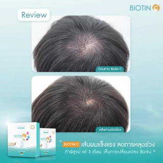 Vdesign Biotin C+ วิตามินลดผมร่วง เพิ่มผมหนา By Vibhavadi