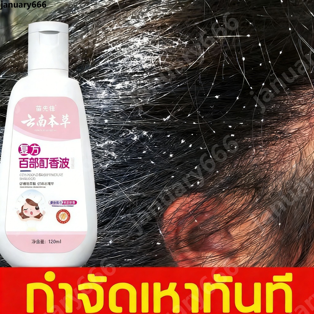 ขจัดเหาถึง99% แชมพูกำจัดเหา แชมพูฆ่าเหา แชมพูสมุนไพร กำจัดเหา และ ไข่เหา หยุดคันใน5-10นาทีสบายหัวเด็กๆชอบ ผิงอันเฮอแบ็ล