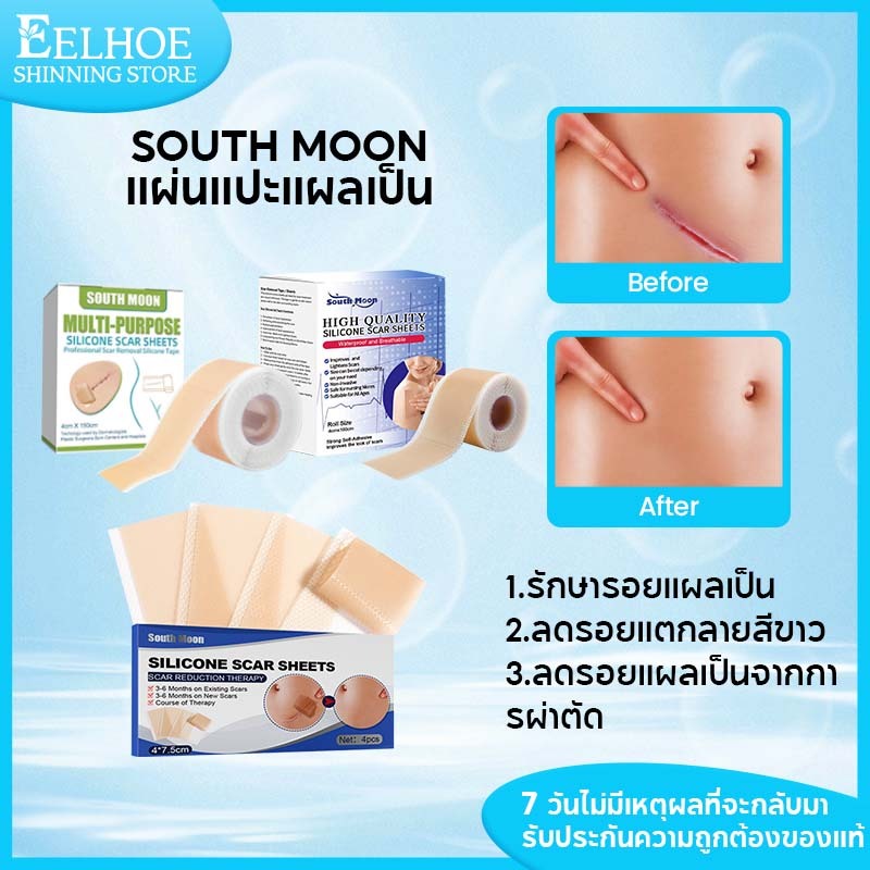 South Moon แผ่นแปะแผลเป็น ซิลิโคนแปะแผลเป็น รักษารอยแผลเป็น ลดรอยแผลเป็น แผลผ่าตัด แผลเป็นลบแผลเป็น
