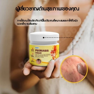 ครีมแก้คันขนาด 20 กรัมนี้ เหมาะสำหรับผิวแห้ง คัน และปัญหาผิวต่างๆ ผลิตจากสารสกัดจากพืช ปลอดภัยสำหรับผู้ที่เป็นโรคสะเก็ดเ