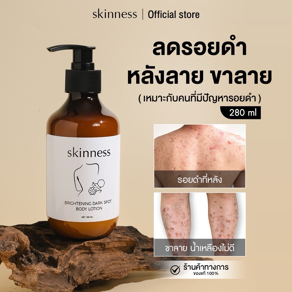 [พร้อมส่งทุกวัน] skinness brightening dark spot body lotion | ครีมลดรอยบำรุงผิวกายฝาดำ