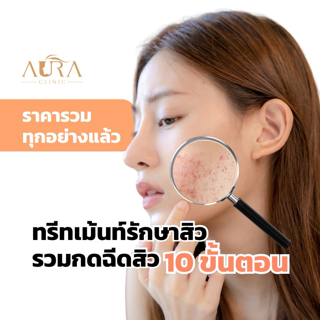 ทรีทเม้นท์รักษาสิวรวมกดฉีด 10 ขั้นตอน Aura Clinic เชียงใหม่(เข้ารับบริการที่คลินิก)