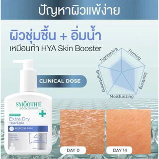 [180 ml.] Smooth E เซรั่มบำรุงผิวกาย เข้มข้นระดับโดส จัดการปัญหาผิวตรงจุด พร้อมส่ง (3 สูตร)