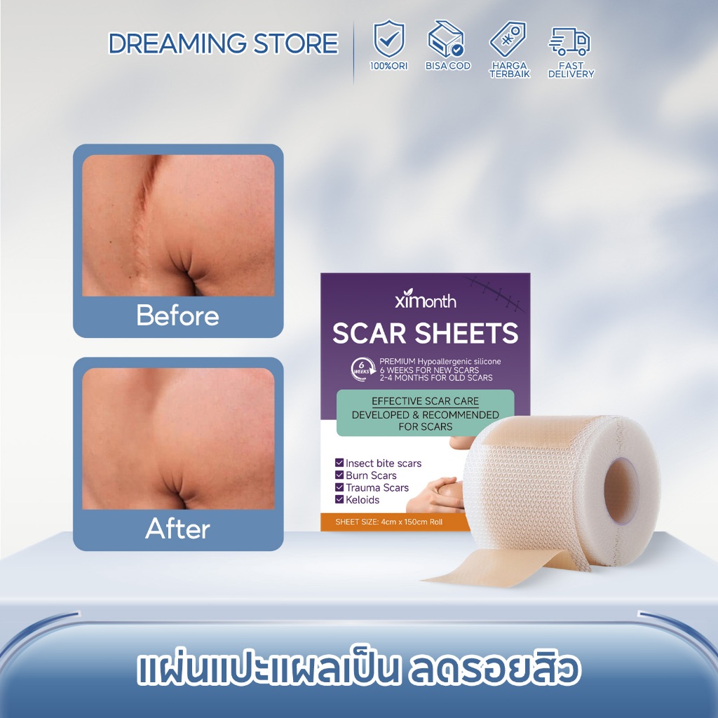 Ximonth แผ่นแปะแผลเป็น ลดรอยสิว รอยแผลเป็น กําจัดรอยแผลเป็นจากแผลเป็น คีลอยด์ 4*150 ซม Silicone Scar Sheet
