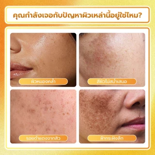 POPASKIN 577+377 Radiance Glow Serum เซรั่มผิวขาว ลดรอยสิว ผิวกระจ่างใส ฉ่ำโกลว์ ลดผิวหมองคล้ำ ลดจุดด่างดำ ผิวกระจก 30ML