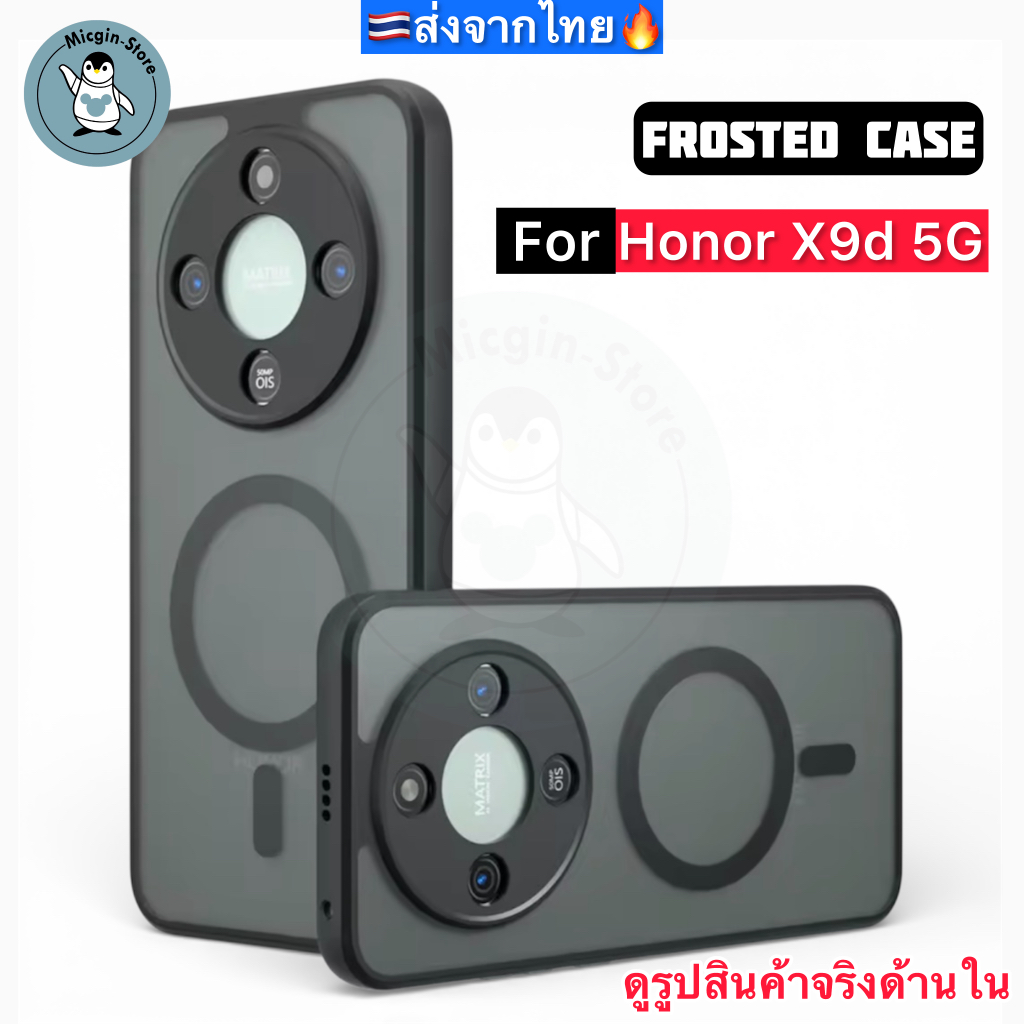 เคส สำหรับ Honor X9d 5G / HonorX9d 🔥Frosted Case เคสกันกระแทก ฝาหลังแข็ง แบบด้าน ส่งจากไทย🇹🇭