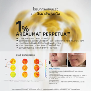 That i Love คอร์ส 15 วัน #ทรีตเมนต์เปลี่ยนผิว 3 มิติ | Travel Size Hydro Miracle Treatment ดูแลผิวเครียด, Skin Barrier