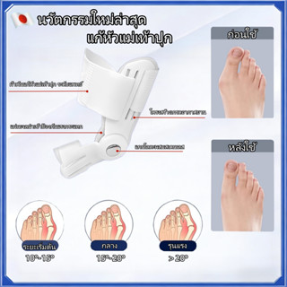 ที่คั่นนิ้วเท้า การแก้ไขนิ้วเท้าใหญ่สามารถบรรเทาอาการปวดเท้า…