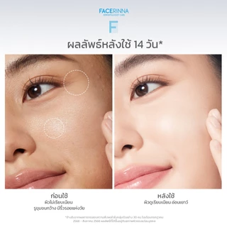 Facerinna Retinol Anti Aging Serum เซรั่มลดริ้วรอย ฟื้นบำรุงผิวอ่อนเยาว์ ปรับผิวเรียบเนียน กระชับ ลดสิว ผิวกระจ่างใส