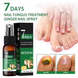 ฟื้นฟูเล็บให้ดูสะอาด สุขภาพดีใน 7 วัน 7 DAYS+ Nail Fungus Treatment สูตรธรรมชาติ อ่อนโยน แต่จัดการเชื้อราได้ตรงจุด