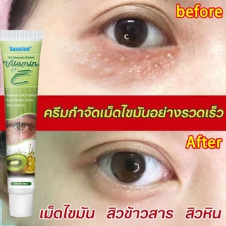 ครีมบำรุงรอบตา ครีมทาตาเม็ดไขมัน อายครีมกำจัดเม็ดไขมัน สิวข้าวสาร สิวหินอย่างมีประสิทธิภาพ กระชับผิว ผิวชุ่มชื้นเนียนนุ่