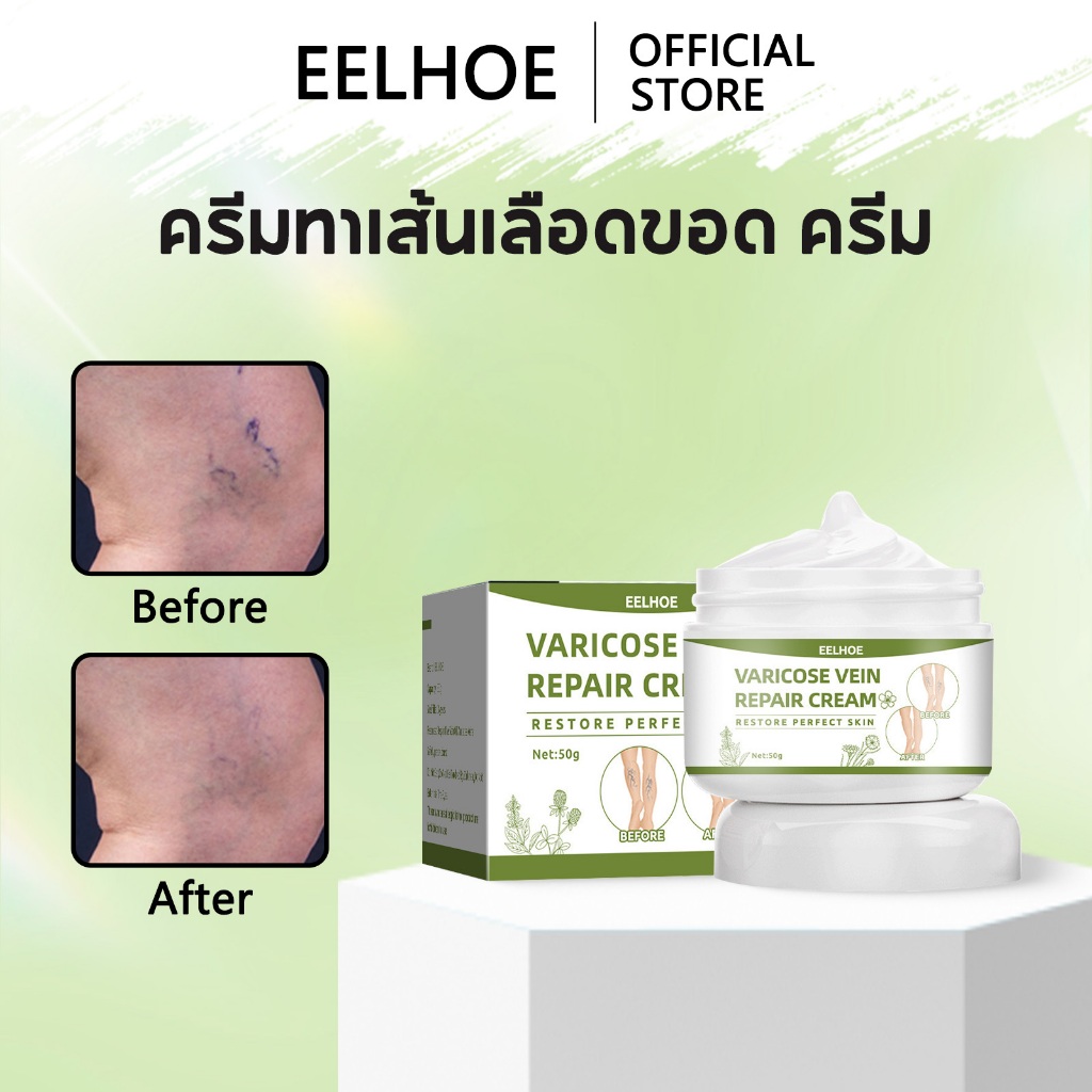 EELHOE ครีมทาเส้นเลือดขอด ครีม รักษาขาให้สวย ขาเนียนเรียบ ผิวขาวใสไร้ที่ติ ส่งเสริมการไหลเวียนโลหิต