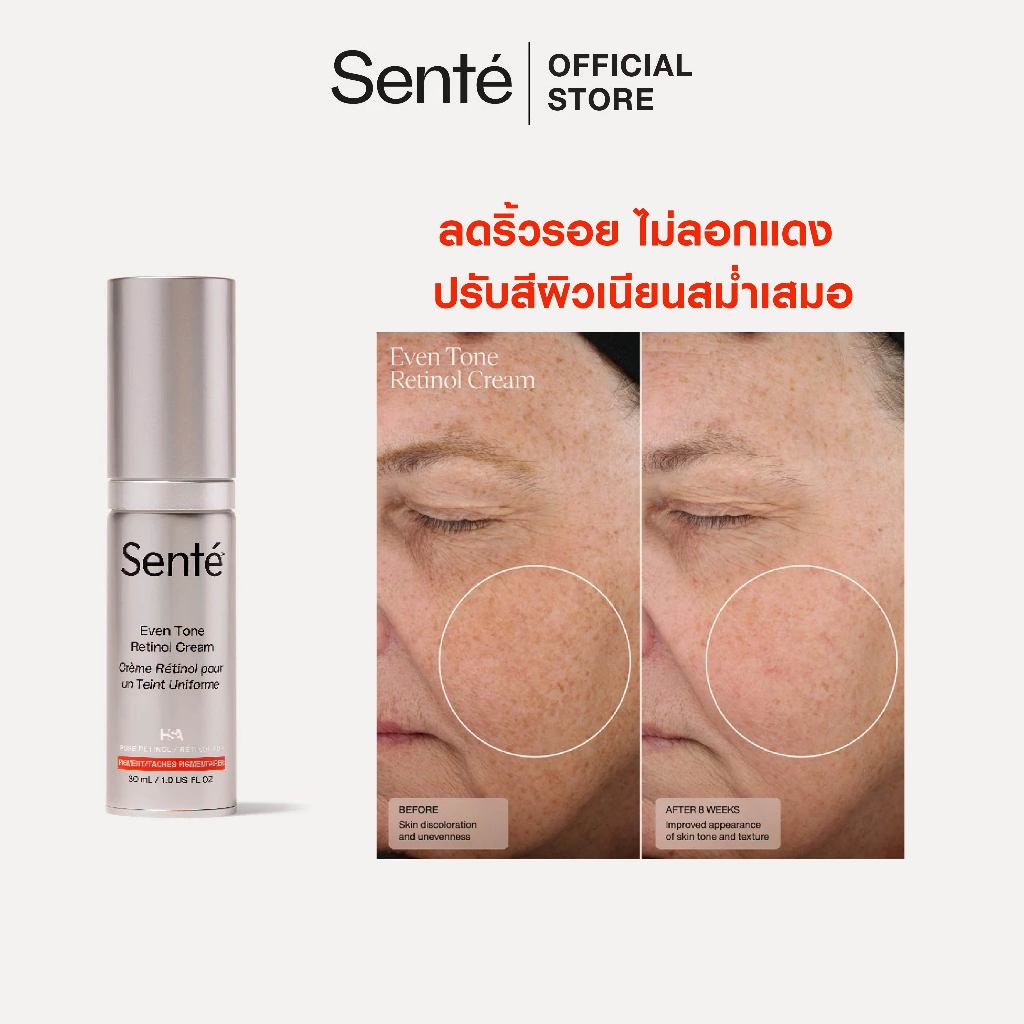 SENTE EVEN TONE RETINOL CREAM 30ML ลดริ้วรอย ไม่ลอกแดง ปรับสีผิวเนียนสม่ำเสมอ [Medical Grade]