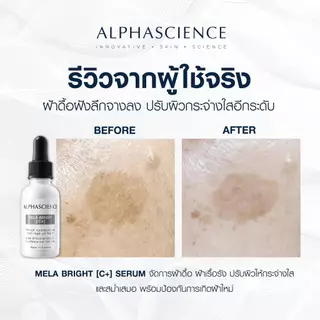 ALPHASCIENCE MELA BRIGHT SERUM [C+] 1.5 ML เซรั่มจัดการฝ้าดื้อถึงต้นตอเผยผิวกระจ่างใสดุจคริสตัล