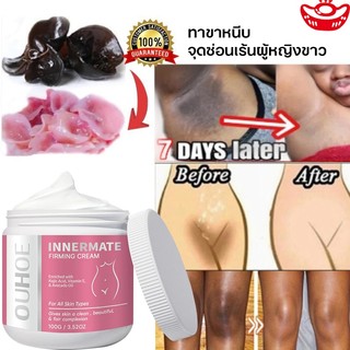 🔥🔥🔥【พร้อมส่งในไทย】 การจัดส่งในประเทศไทยครีมทา ก้นดำ รักแร้ดำ ขาหนีบดำ สิวหลัง หัวเข่าดำ ศอกดำ ลบเลือนรอยดำ แตกลาย คอดำ