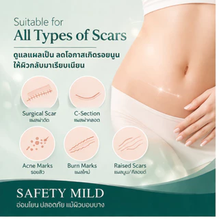 แผ่นแปะลดรอยแผลเป็นนูนแปะแผลผ่าคลอดแผ่นแปะซิลิโคน Silicone scar sheetsสินค้าได้รับการรับรองมาตราฐานจากนวัตกรรม IRELAND